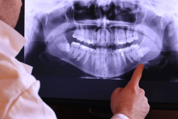 Best Broken or Cracked Tooth Emergency Dentist in Billings, MT